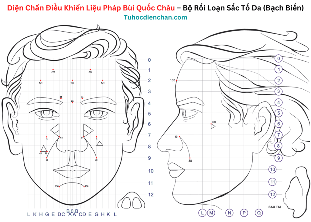 Bộ huyệt Diện Chẩn Rối Loạn Sắc Tố Da (Bạch Biến)