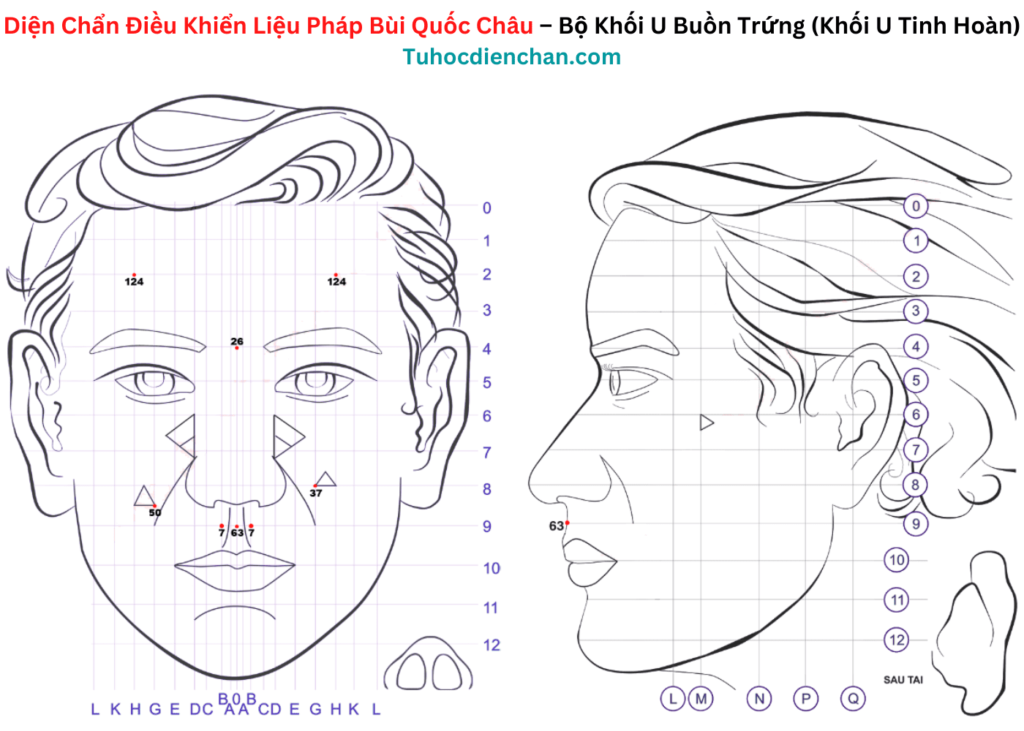 Bộ huyệt Diện Chẩn Khối U Buồn Trứng (Khối U Tinh Hoàn)