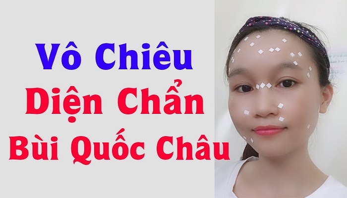 Giản Thuật Vô chiêu Diện Chẩn Là Gì