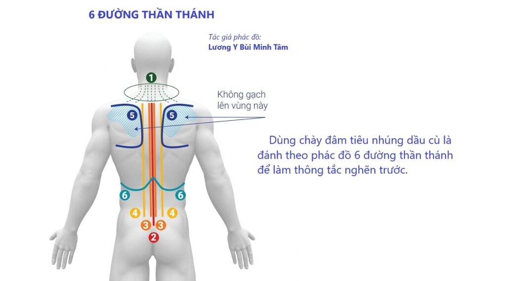 Cách Chữa Viêm Thần Kinh Tọa Bằng Diện Chẩn - Lương Y Hoàng Chu