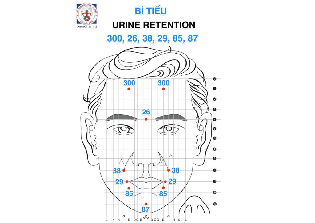 Bộ Bí Tiểu, Tiểu Gắt (Unrine Retention) Diện Chẩn Bùi Quốc Châu