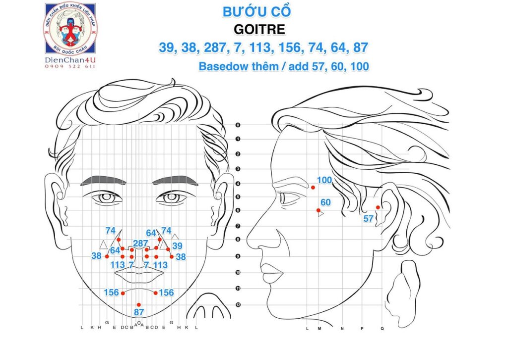 Bộ Huyệt Trị Bướu Cổ (Goitre) Diện Chẩn Bùi Quốc Châu