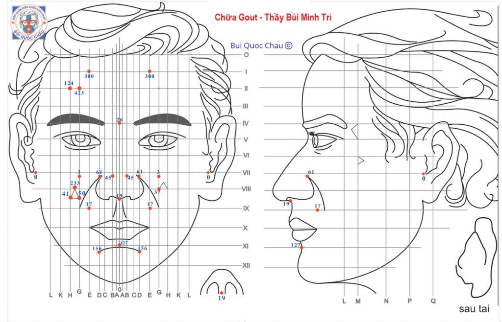 Cách Thực Hiện 3 Phác Đồ Chữa Bệnh Gout (Gút) Diện Chẩn