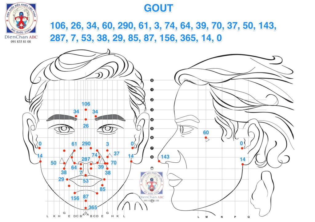 Cách Thực Hiện 3 Phác Đồ Chữa Bệnh Gout (Gút) Diện Chẩn
