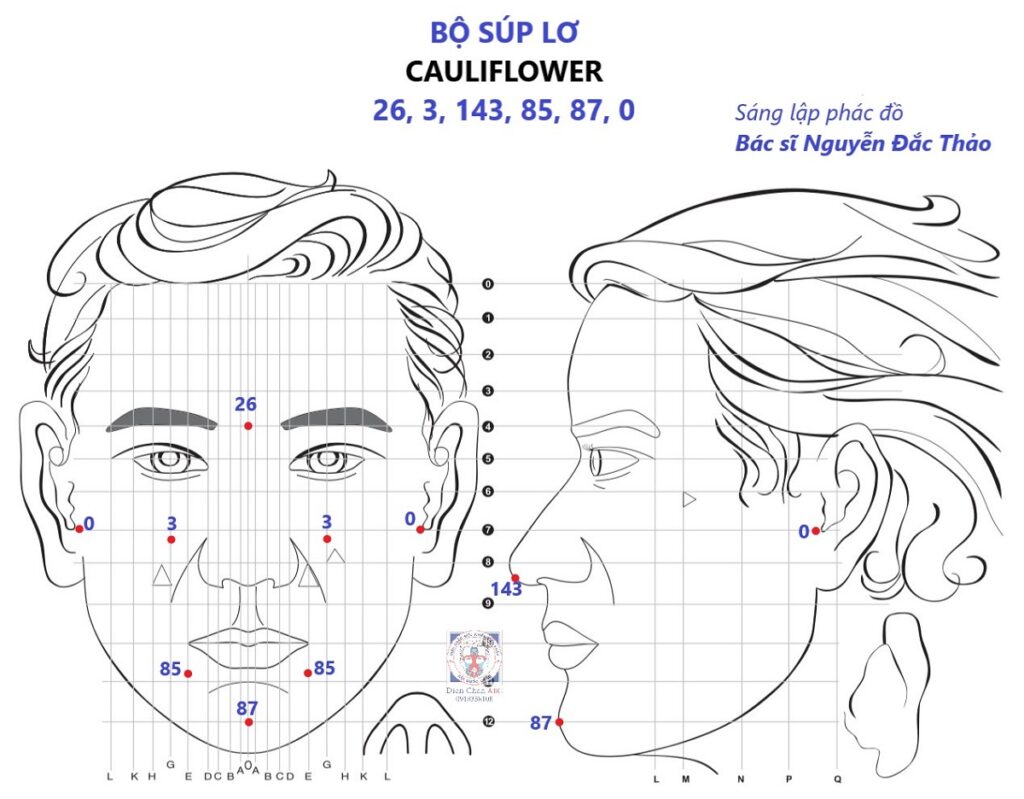 Cách Thực Hiện Phác đồ Súp Lơ Diện Chẩn - Bác Sĩ Nguyễn Đắc Thảo