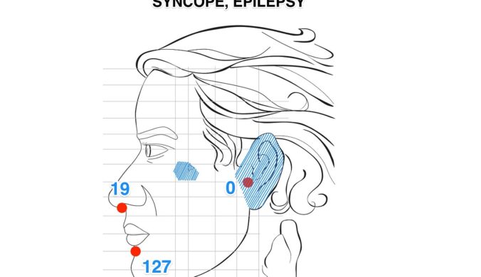 Cách Xử Lý Ngất Xỉu, Kinh Phong (Syncope, Epilepsy) Bằng Diện Chẩn Bùi Quốc Châu