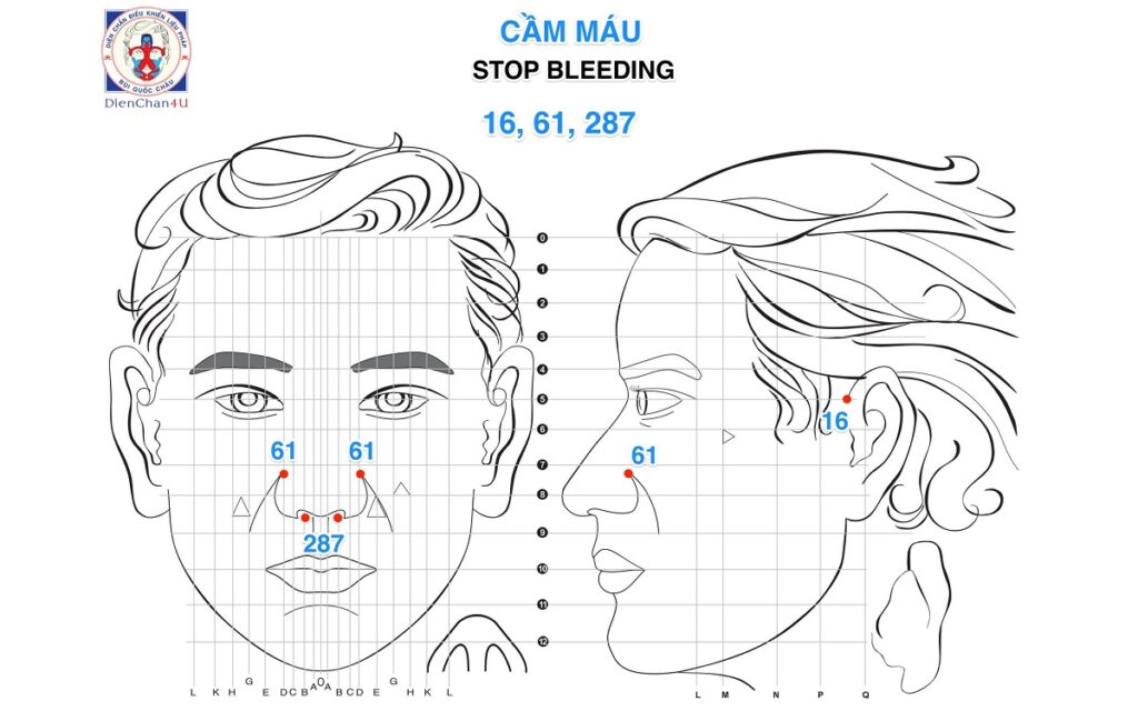 Cầm Máu (Stop Bleeding) Bằng 3 Huyệt Diện Chẩn: 16, 61, 127