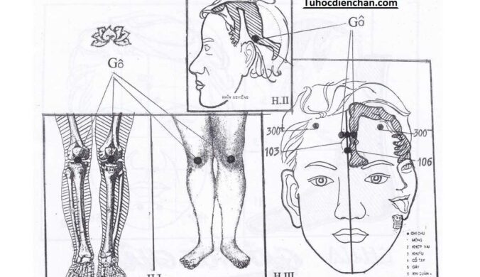 Cách Chữa Gai Khớp Gối Bằng Diện Chẩn - Phác Đồ Hoàng Chu