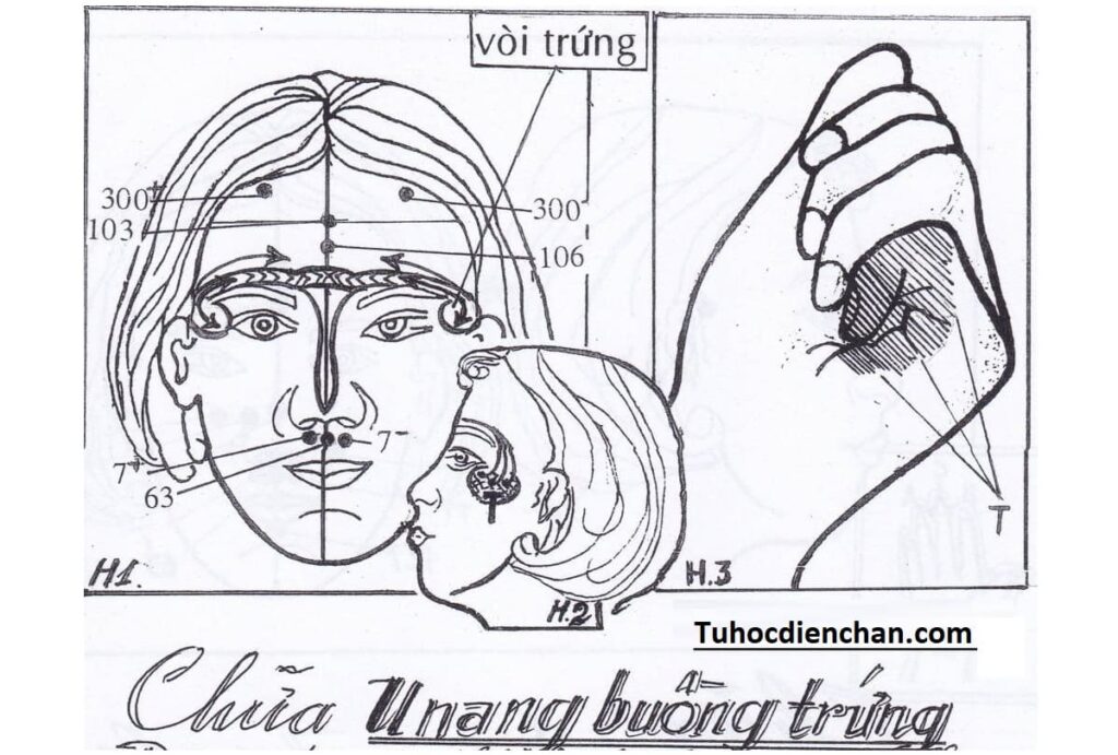 Cách Thực Hành Chữa U Nang Buồng Trứng Bằng Diện Chẩn – Lương Y Hoàng Chu