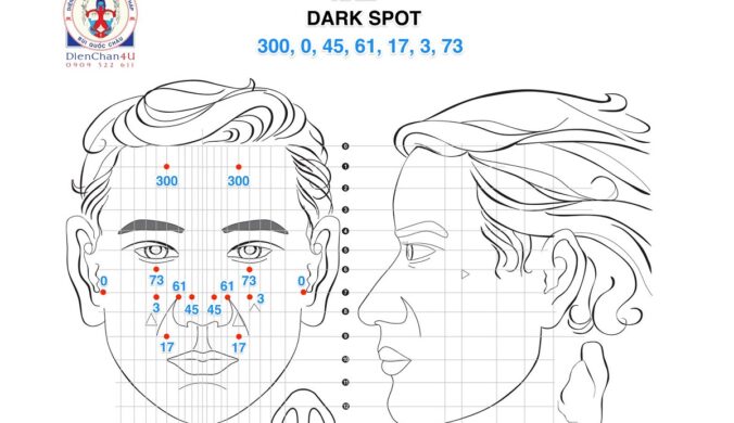 Phác Đồ Huyệt Và Cách Trị Nám (Dark Spot) Bằng Diện Chẩn Bùi Quốc Châu