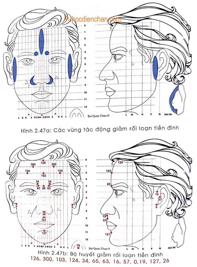 Xử Lý Rối Loạn Tiền Đình, Chống Mặt Chuyên Sâu Bằng Diện Chẩn