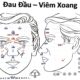 Cách Chữa Đau đầu - Viêm Xoang Bằng Diện Chẩn - Lương Y Huỳnh Văn Phích