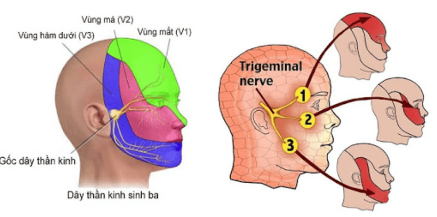 Cách Chữa Đau Dây Thần Kinh Số 5 Bằng Diện Chẩn – Lương Y Hoàng Chu